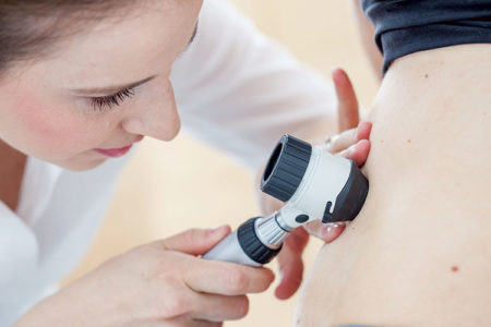 How to Recognise Melanoma