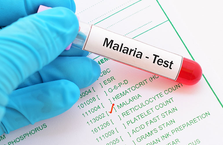 Malaria