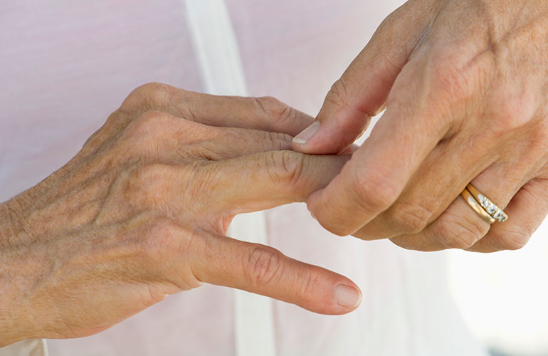 Conditions that can mimic arthritis pain